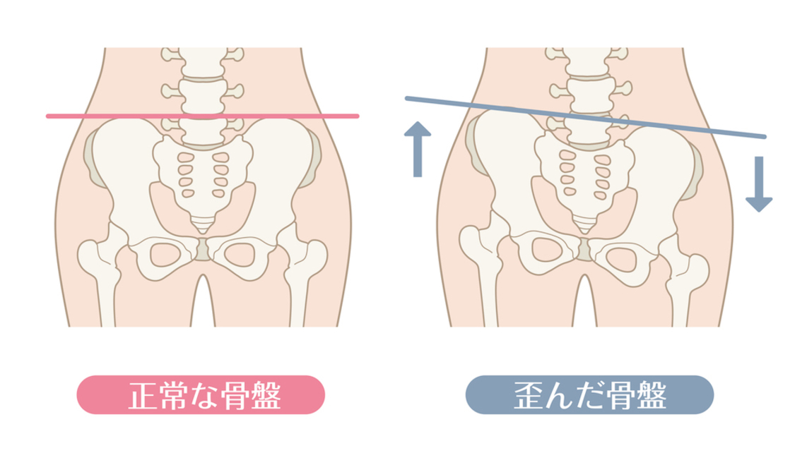 あなたの腰痛が良くならない理由